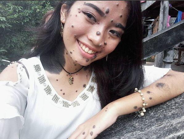 Masuk Kontes Kecantikan, Tubuh Perempuan Ini Beda dari yang Lain