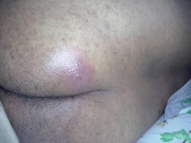 viral : istri di gugat cerai gara gara warna pantat