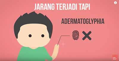 Kenapa Sidik Jari Berbeda-beda? *Explained With Animation*