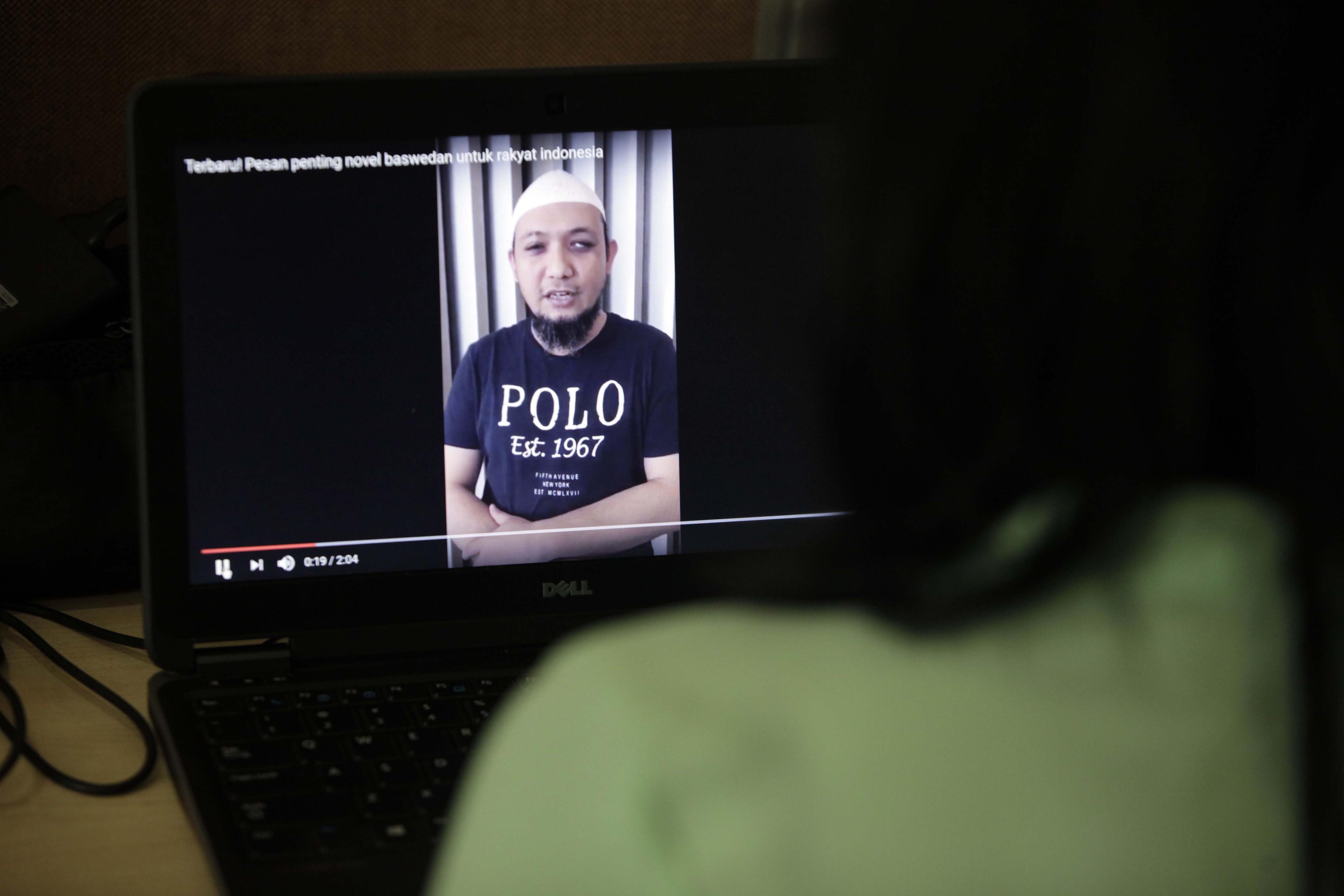 Novel Sebut Polisi tak Berani Ungkap Kasus Penyiraman Air Keras