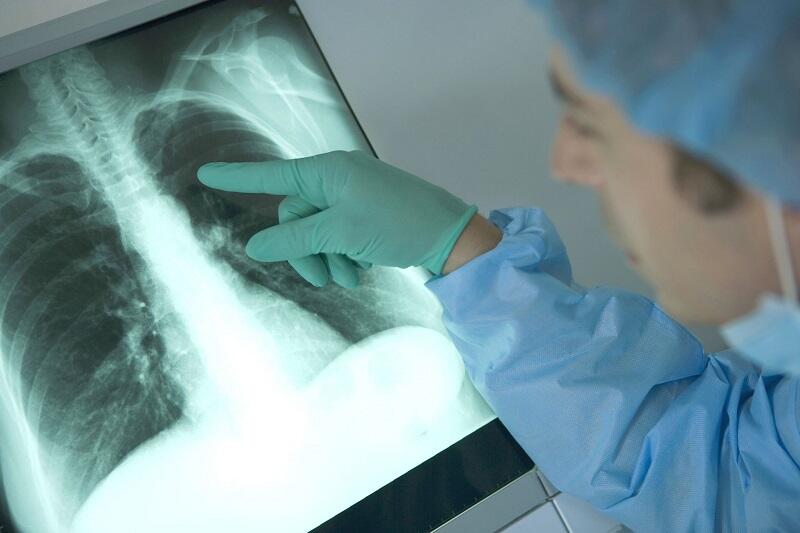 Ngeri! Benda-benda Ini Dikeluarkan Dokter dari Tubuh Manusia