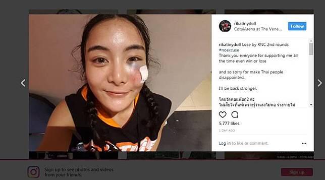 Dihajar Lawan, Wajah Cantik Atlet MMA Thailand Berubah Drastis