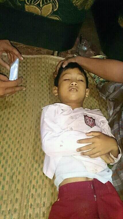 Lagi !! Kasus Kekerasan Dilingkungan Sekolah Ini Merenggutnya.