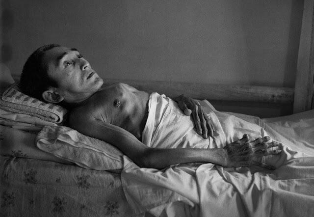 (Mengerikan) Inilah Foto Korban Bencana Nuklir