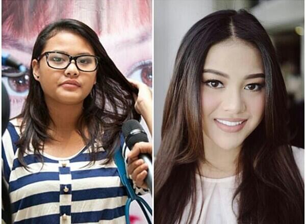 9 Artis Ini Dulu Tembam Sekarang Tirus, Operasi Atau Alami?