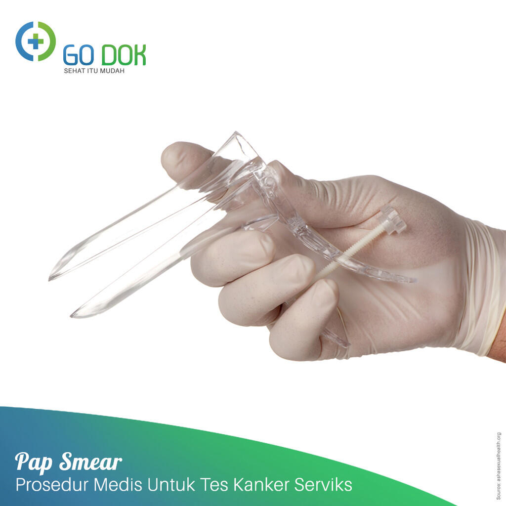 Pap Smear; Tes Kanker Rahim yang Wajib Dicoba Wanita