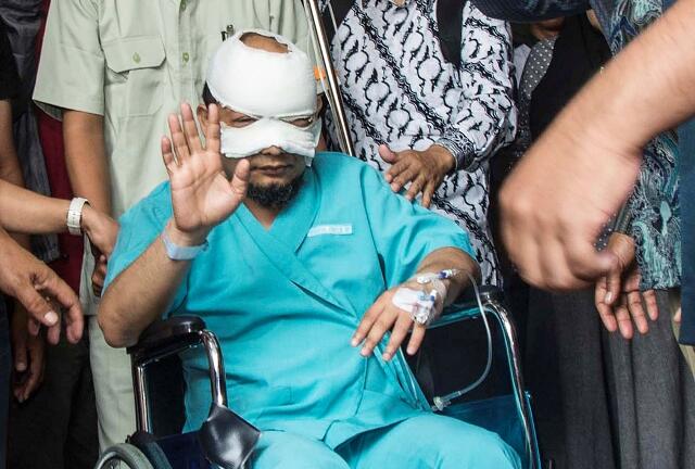 Mata Kanan Novel Baswedan Membaik