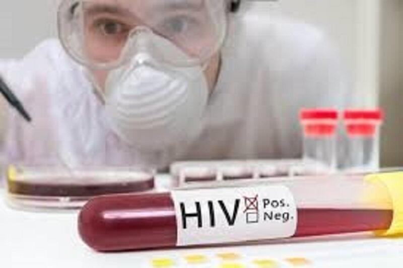 Ternyata Ini Dia Fakta Dibalik HIV/AIDS! Masuk Gan!