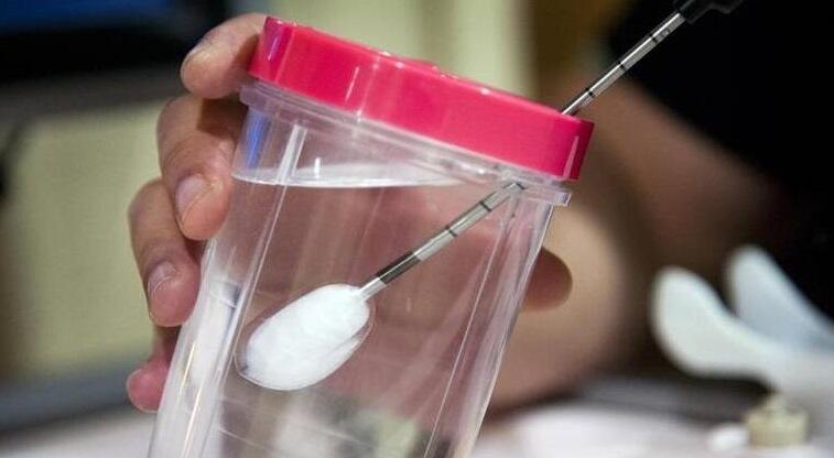 Anda Penderita Kanker Payudara? Tenang Ada Teknologi Israel Pembunuh Kanker Payudara