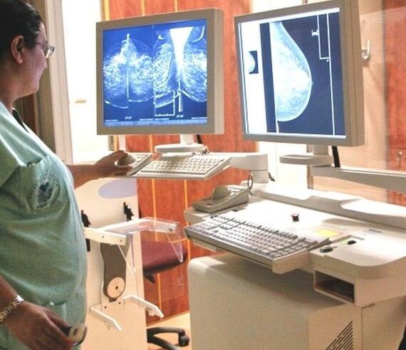 Anda Penderita Kanker Payudara? Tenang Ada Teknologi Israel Pembunuh Kanker Payudara