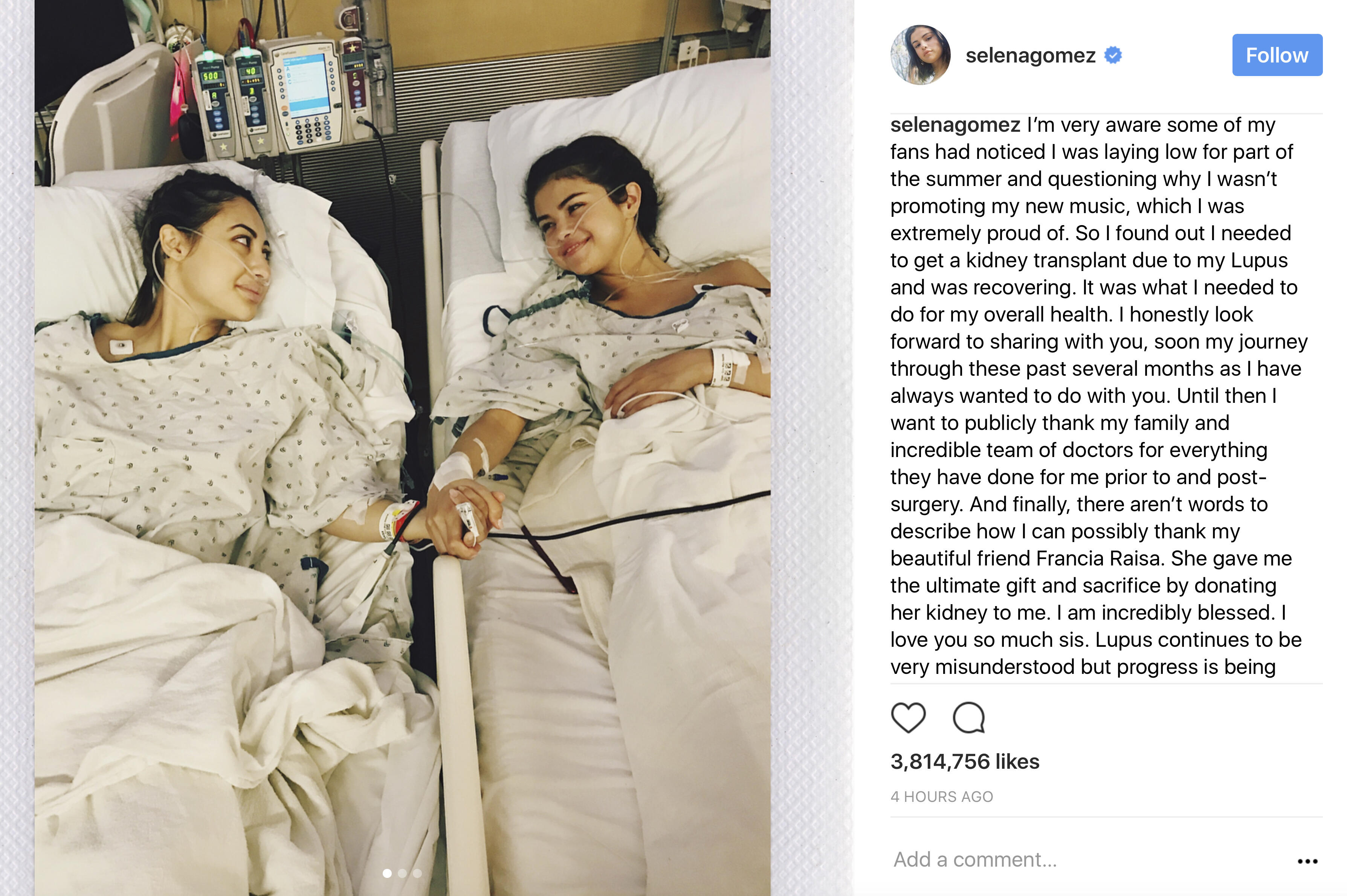 Selena Gomez Sukses Jalani Transplantasi Ginjal