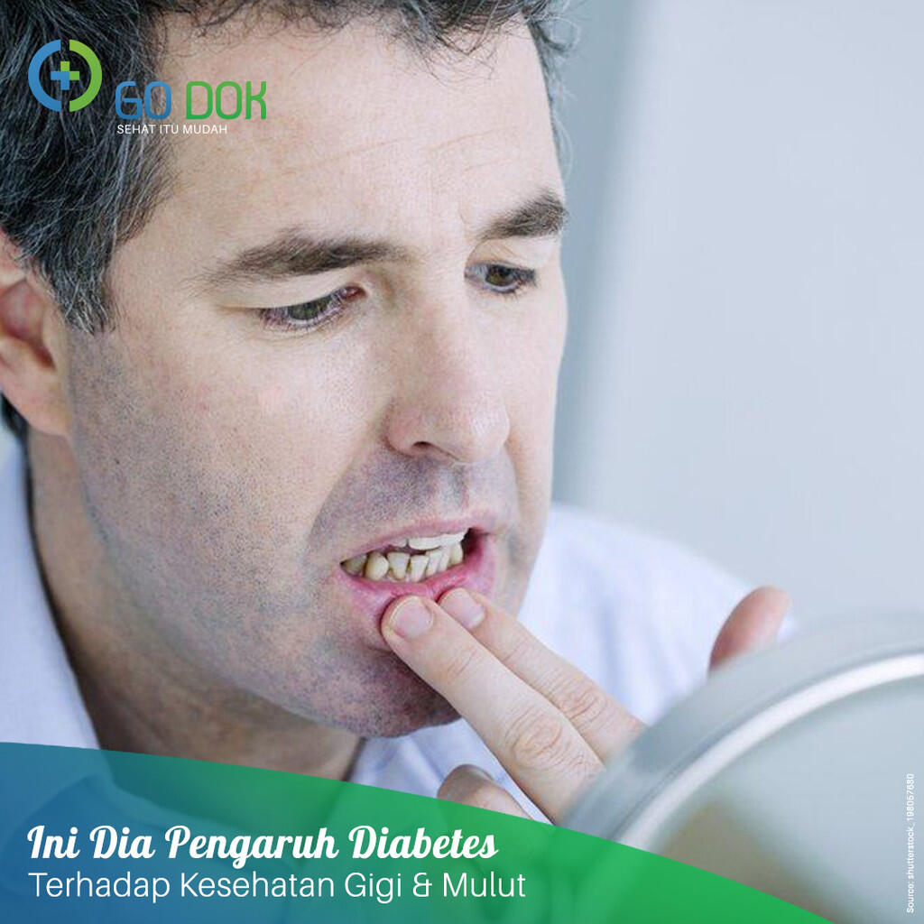 Sakit Gigi Berlubang Ini Penanganannya Alodokter Sakit Gigi Berlubang Ini Penanganannya Alodokter
