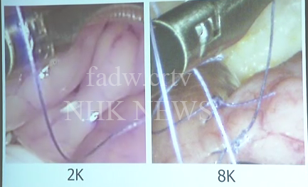 Endoscope Berkamera 8K Ini Siap Membantu Di Dunia Medis