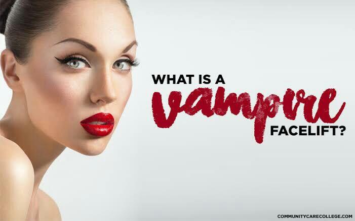 Mengenal Vampire Facelift, Perawatan Kulit Menggunakan Darah
