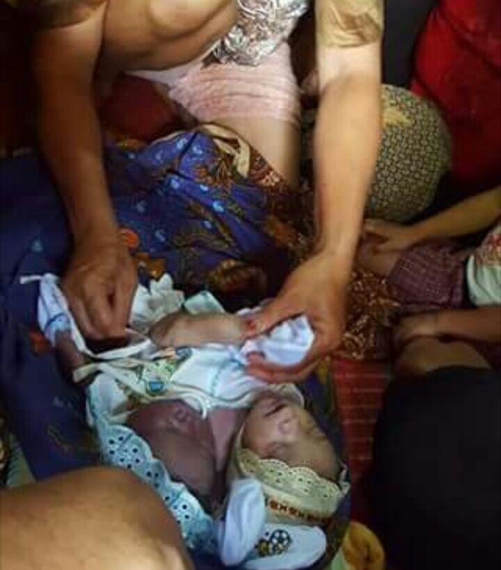 Bayi Dengan Dua Kepala Satu Badan Lahir Di Tapanuli Tengah