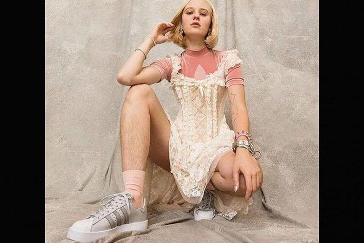 Model Swedia Diancam Diperkosa karena Unggah &ldquo;Kaki Berbulu&rdquo;