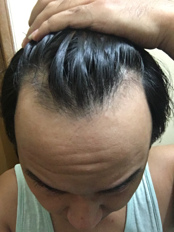  Model  Gaya Rambut  Pria Botak  Terbaru Cahunit com