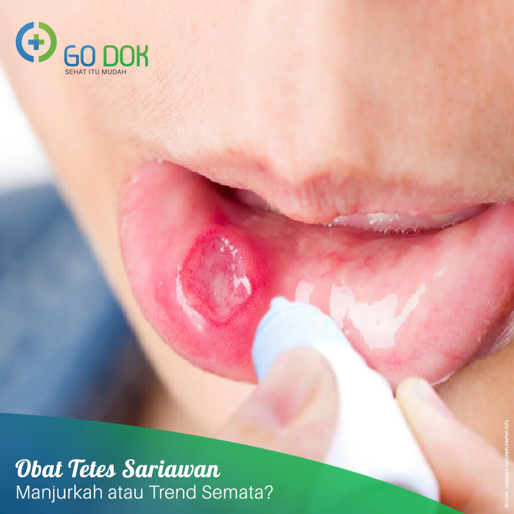 Obat Sariawan Tetes untuk Sembuhkan Sariawan, Manjurkah? | KASKUS