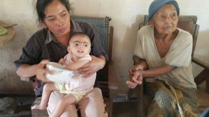 Mengidap Penyakit Langka, Balita Ini Juga Menderita Kebocoran Jantung dan Hernia