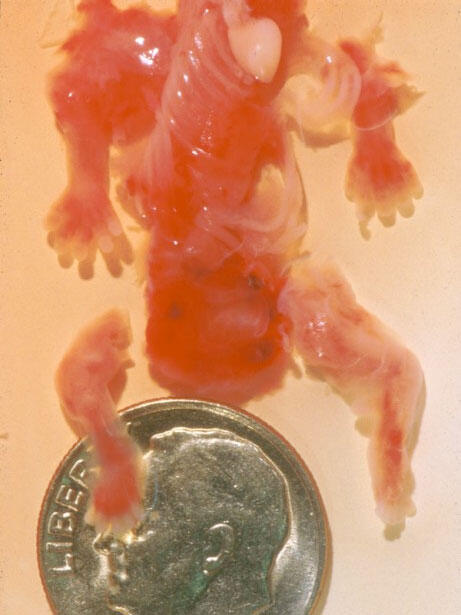 Stop Aborsi Pengertian, Akibat dan Hukumnya &#91;Disertai Foto Bayi Hasil Aborsi&#93;