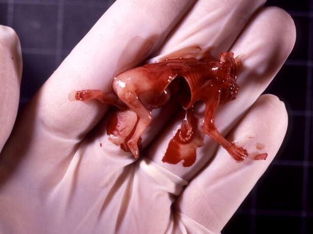 Stop Aborsi Pengertian, Akibat dan Hukumnya &#91;Disertai Foto Bayi Hasil Aborsi&#93;