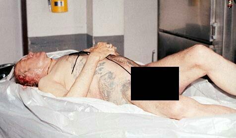 Kelainan Seksual Auto Erotic Asphyxiation