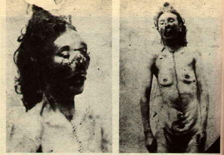 Misteri Jack the Ripper (bagian 1) : Para Korban