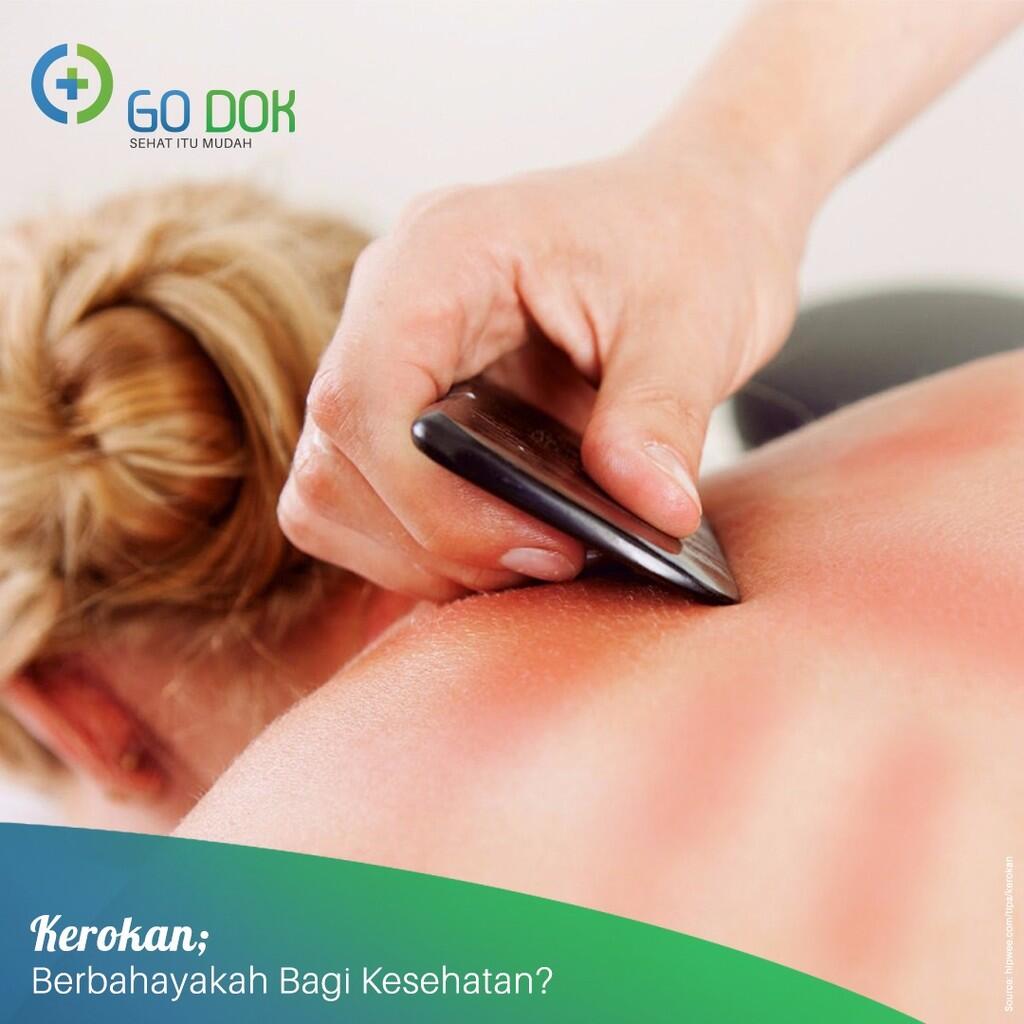 Kerokan; Berbahayakah Bagi Kesehatan?