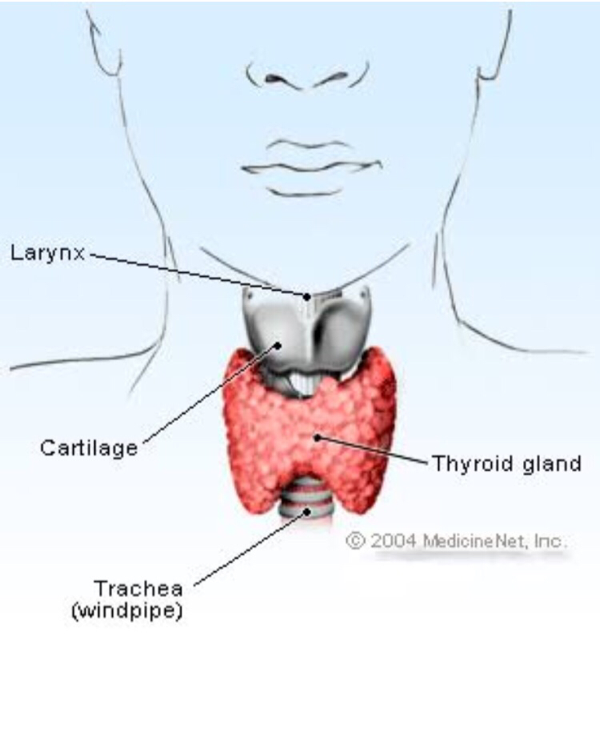 Pengobatan herbal thyroid ( Gondok ) 