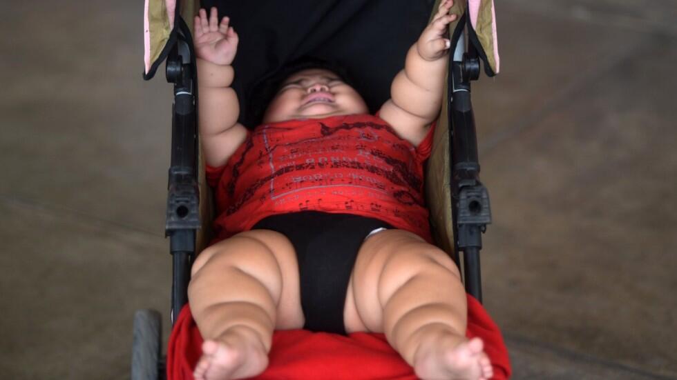 Baru Berumur 10 Bulan, Berat Balita ini Sudah Capai 28 Kg