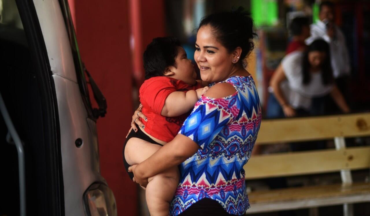 Baru Berumur 10 Bulan, Berat Balita ini Sudah Capai 28 Kg
