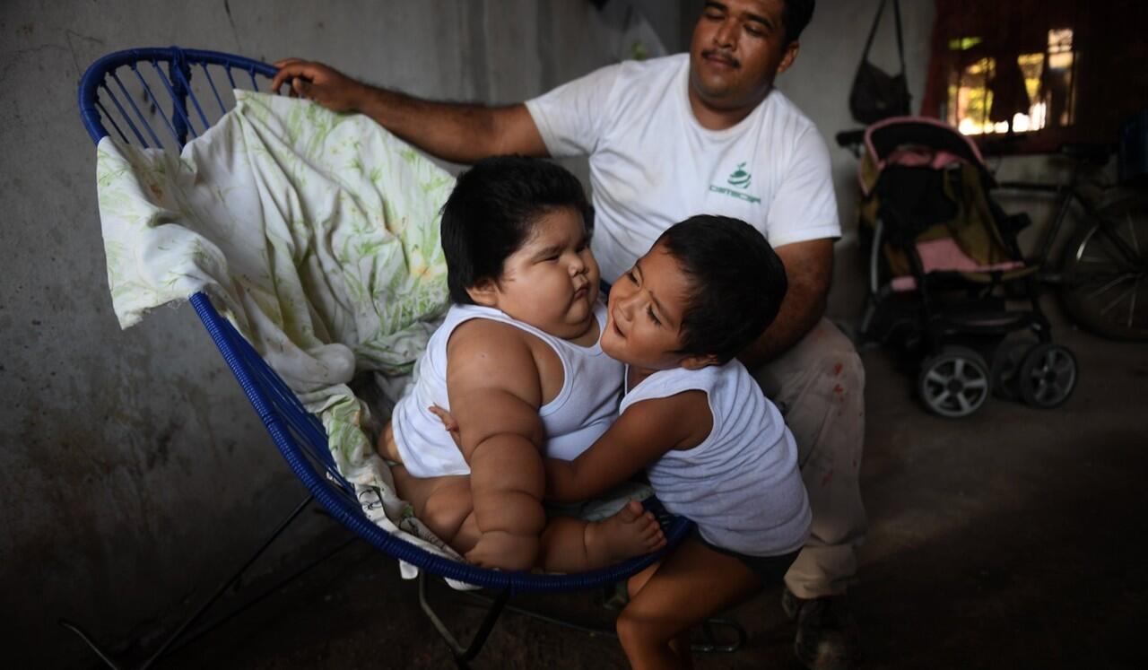 Baru Berumur 10 Bulan, Berat Balita ini Sudah Capai 28 Kg