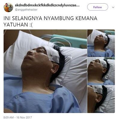 Nahas! Setya Novanto Kecelakaan, Netizen Malah Jahat Begini