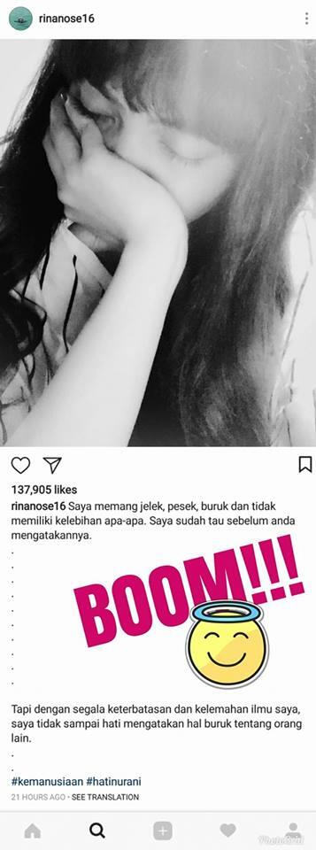 Disebut Artis Jelek &amp; Pesek oleh Ust. Abdul Somad, Rina Nose Curhat di Instagram