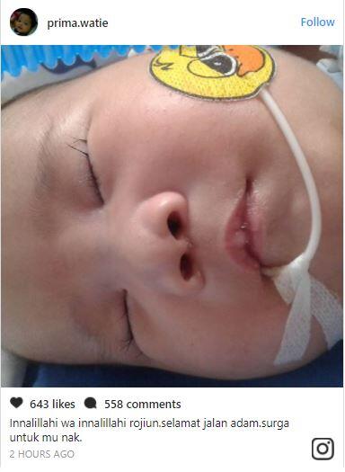 Adam Fabumi, Bayi Lucu dengan Penyakit Langka Meninggal Dunia