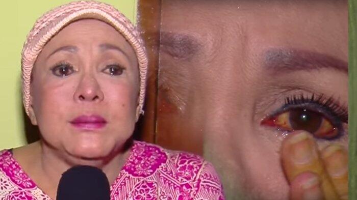 Siapa Sangka, Perempuan yang Dikenal Kocak Ini Ternyata Juga Korban Pelakor