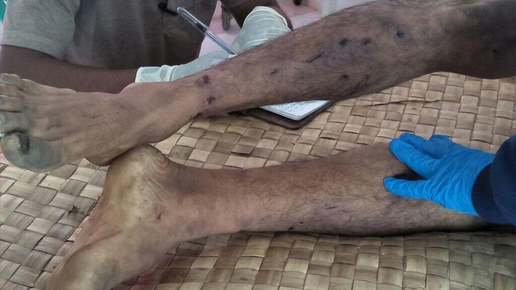Istri La Gode: "Tentara yang Bunuh Suami Saya"