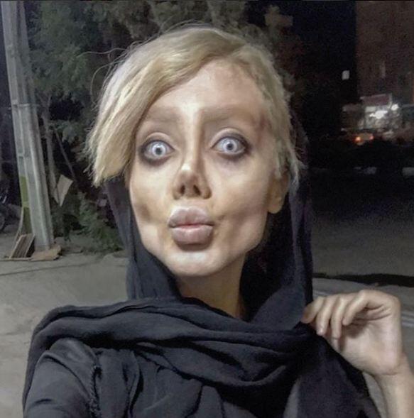 Gadis ini ingin mirip Angelina Jolie, malah berakhir seperti Zombie