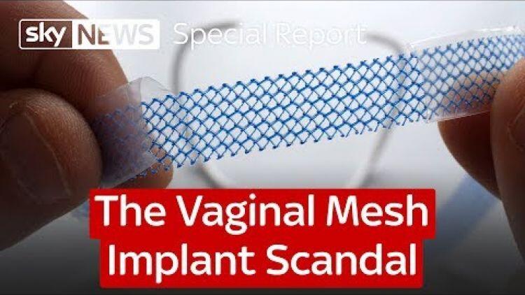 Vagina Implan Yang Kontroversial Resmi Dilarang di Australia