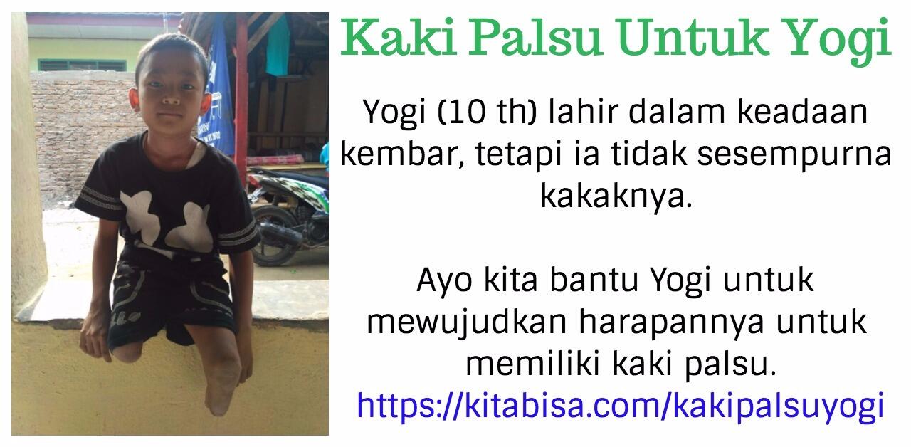 Yuk Kita Bantu Yogi Mewujudkan Harapannya untuk Punya Kaki Palsu!