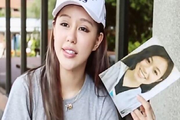 Wanita Ini 30 Kali Operasi agar Mirip Bintang Porno Favorit Pacar