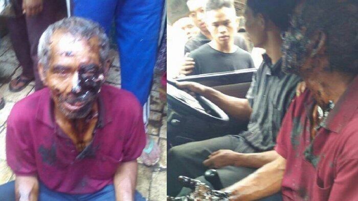 Kasihan gan, Tubuh Seorang Kakek Berlumuran Aspal Panas Akibat Cekcok Dengan Lurah!