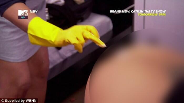 Anal Bleaching, Tren Memutihkan Anal yang Sedang Digandrungi Selebritas Dunia