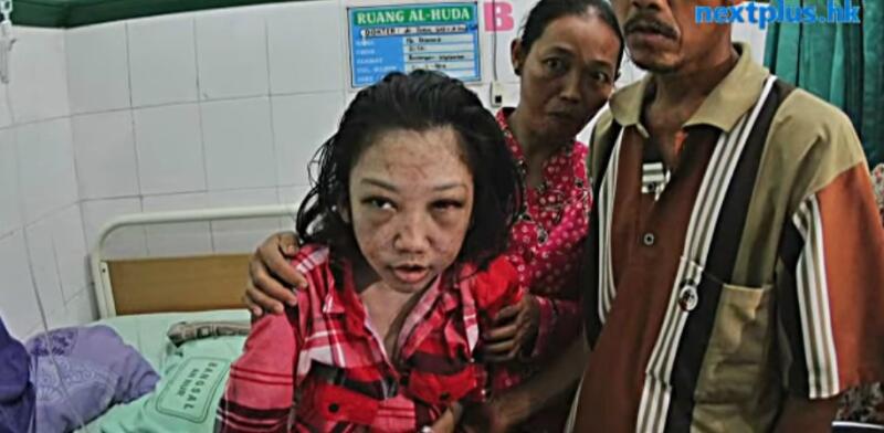 Pembantu Indonesia Menangkan Gugatan Lawan Majikan Hongkong Yang Menyiksa Dan Merenda