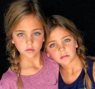 Cantik Sejak Lahir, Dua Anak Ini Disebut Kembar Identik Paling Cantik di Dunia