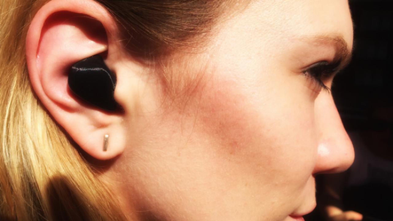 Awas, Ponsel Bisa Bikin Kulit Kamu Jelek Loh Ternyata