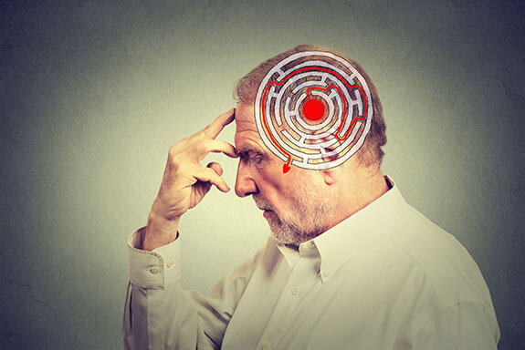 Pakar Neurologi UI Temukan Rumus Pengindentifikasi Migren