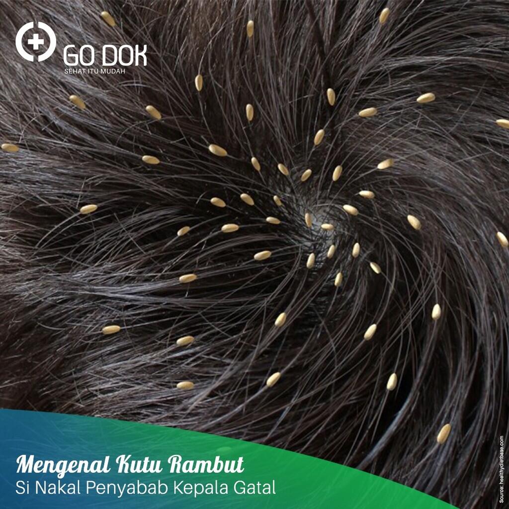 Kutu Rambut Parasit Nakal Penyebab Kepala Gatal Kaskus 5760