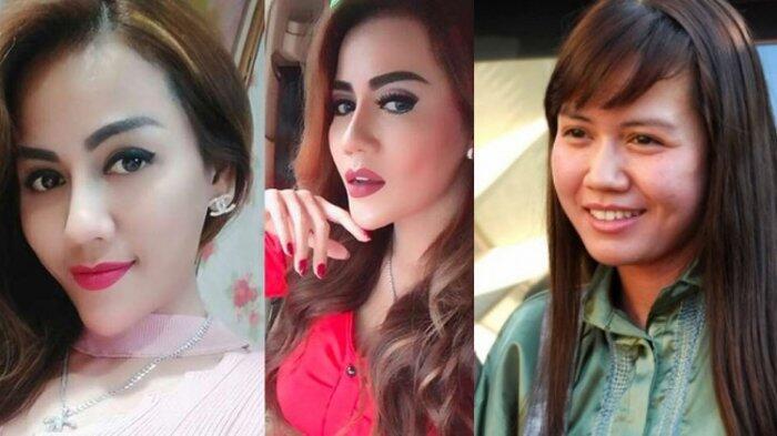 Ingin Wajah Natural, Nita Thalia Operasi Plastik, Ternyata Begini Begini Aslinya