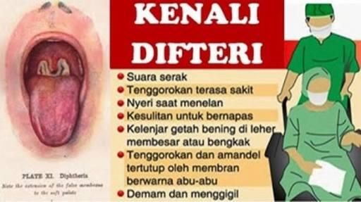 Waspada Difteri Di Tempat Wisata